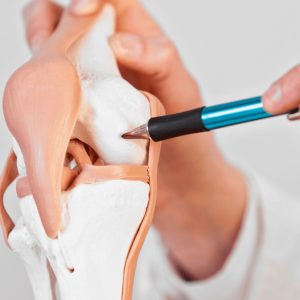 درمان کندرومالاسی یا نرمی کشکک زانو چیست؟