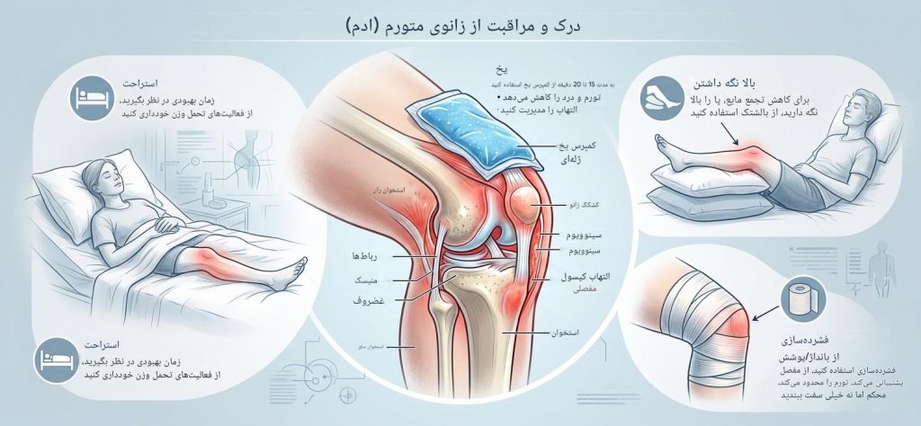 تورم زانو دکتر رضا رضایی متخصص ارتوپد رشت