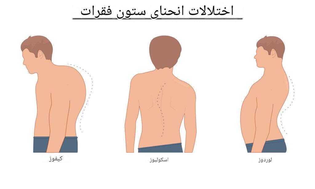 بیماریها و ناهنجاریهای مادرزادی ارتوپدی؛ از نقص استخوان تا بدشکلی مفاصل و ستون فقرات