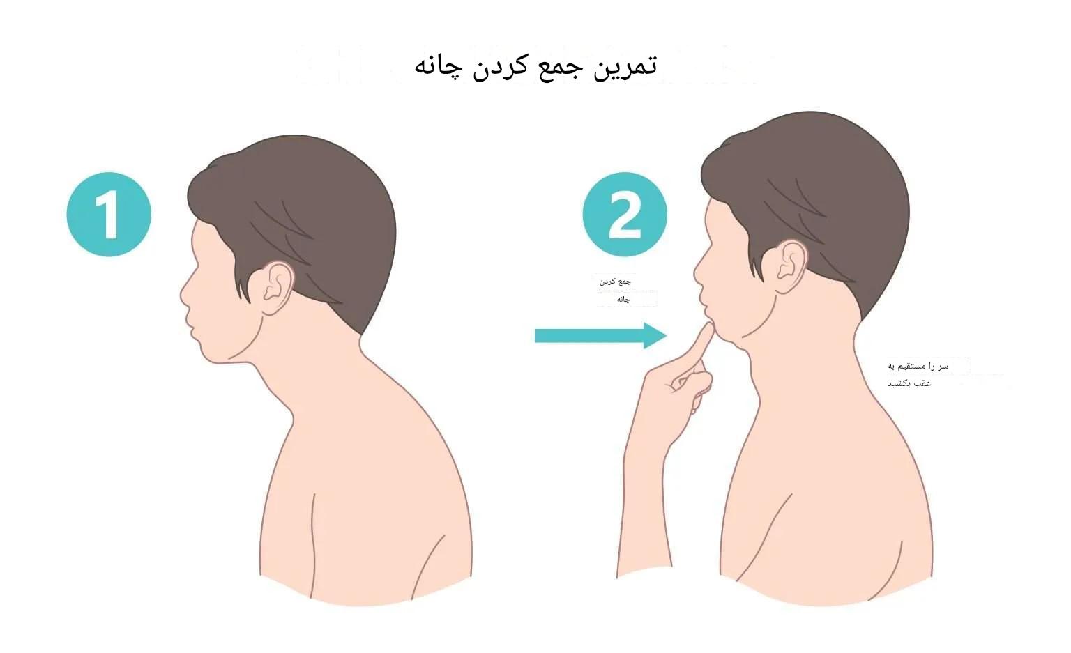 موبایل و قوز گردن؛ درمان گردن درد ناشی از استفاده نادرست از موبایل