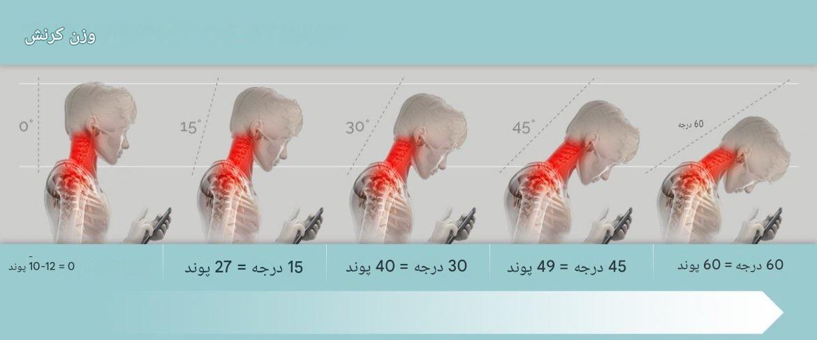 موبایل و قوز گردن؛ درمان گردن درد ناشی از استفاده نادرست از موبایل